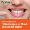 PYRALVEX Oplossing, 10 ml