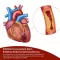 Beh Arterie+ capsules (90 stuks)